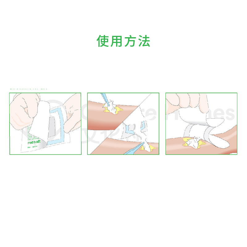 Molnlycke Mesalt 氯化納紗布 5x5cm 30片 盒 - Image 4